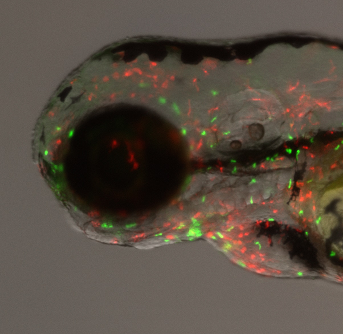 Zebrafish as tools for drug discovery